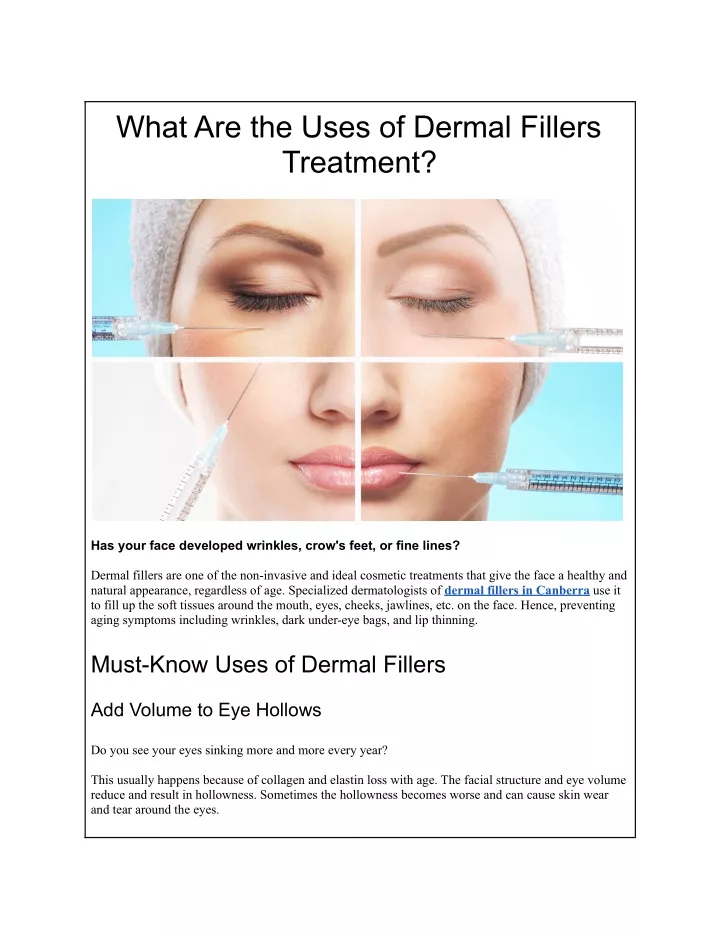 Ppt Uses Of Dermal Fillers Treatment Powerpoint Presentation Free