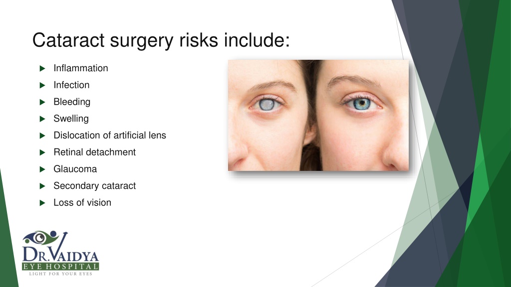 Ppt Cataract Surgery Dr Vaidya Eye Hospital Powerpoint Presentation