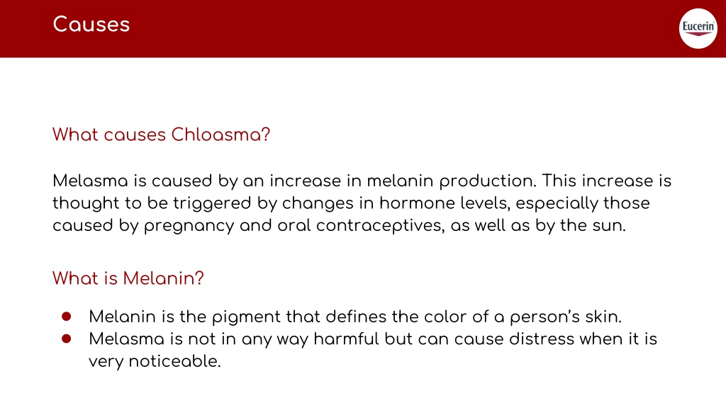 Ppt What Are The Causes And Treatments Of Melasma Powerpoint