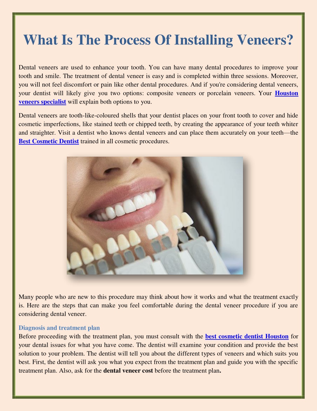 PPT What Is The Process Of Installing Veneers PowerPoint