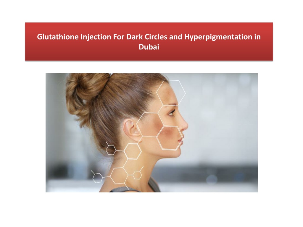 Ppt Glutathione Injection For Dark Circles And Hyperpigmentation In