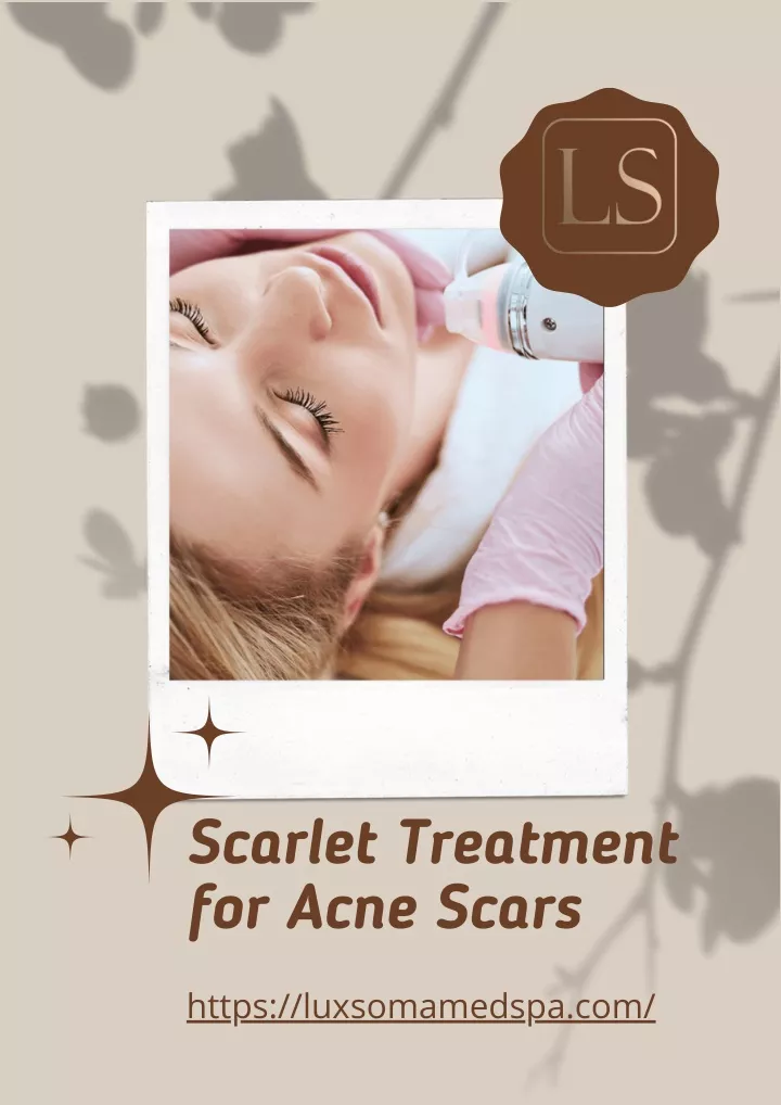 PPT Scarlet Treatment For Acne Scars PowerPoint Presentation Free