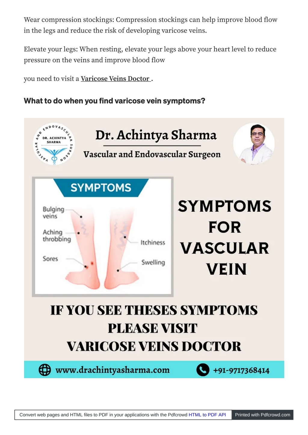 Ppt Varicose Veins Treatment Knowledge Symptoms Powerpoint