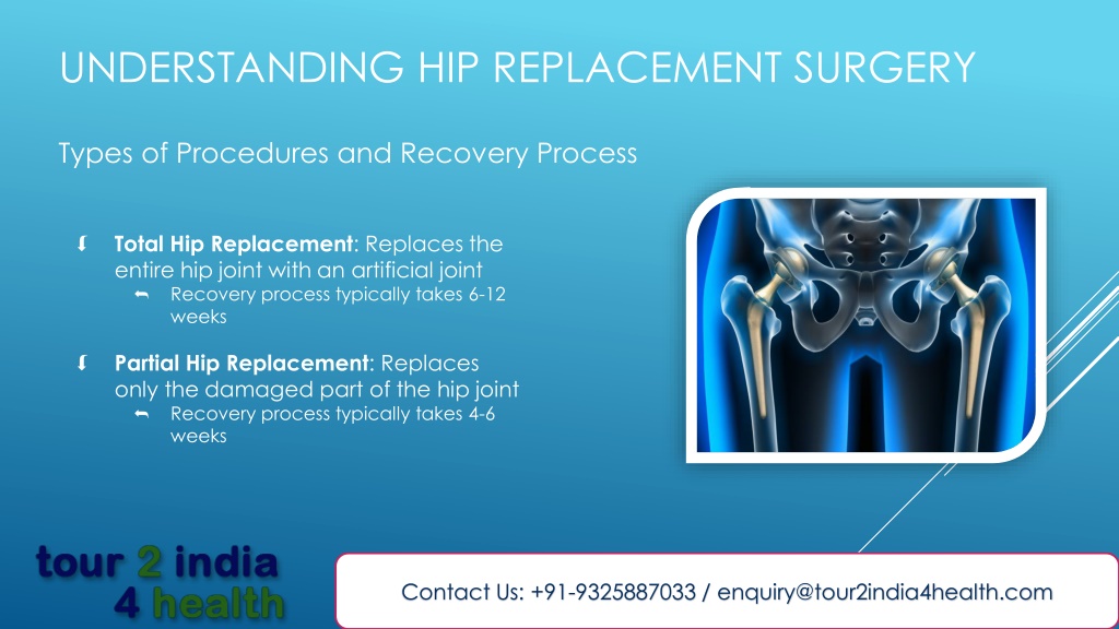 Ppt Cost Of Hip Replacement Surgery India Powerpoint Presentation