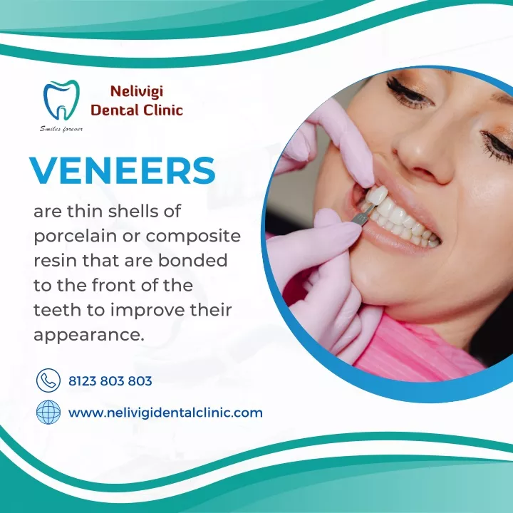 Ppt Veneers Best Dental Clinic In Bellandur Bangalore Nelivigi