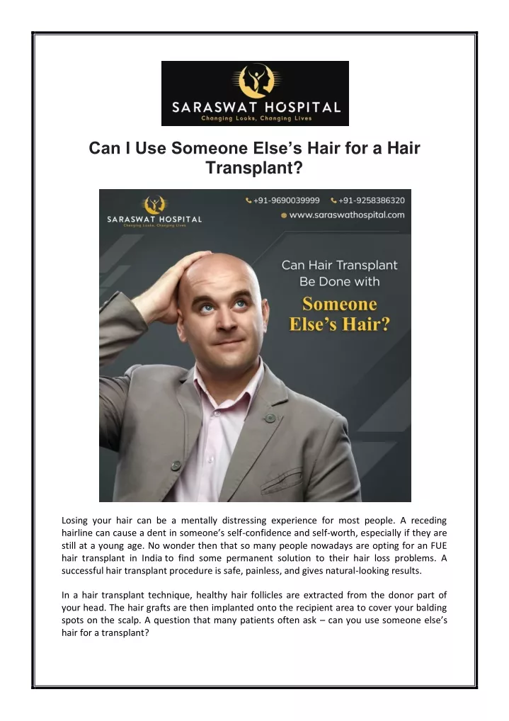 ppt-can-i-use-someone-else-s-hair-for-a-hair-transplant-powerpoint