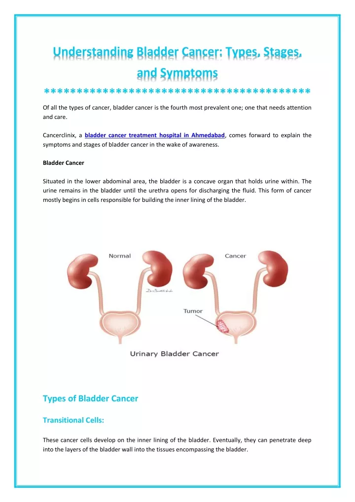 Ppt Everything About Bladder Cancer Powerpoint Presentation Free