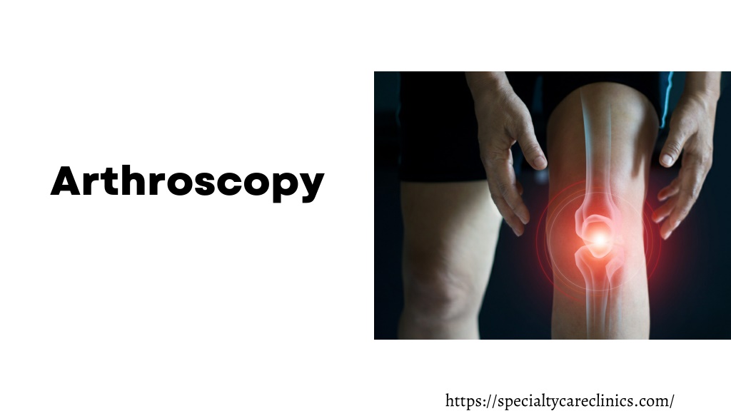 PPT - Arthroscopy PowerPoint Presentation, Free Download - ID:11316191