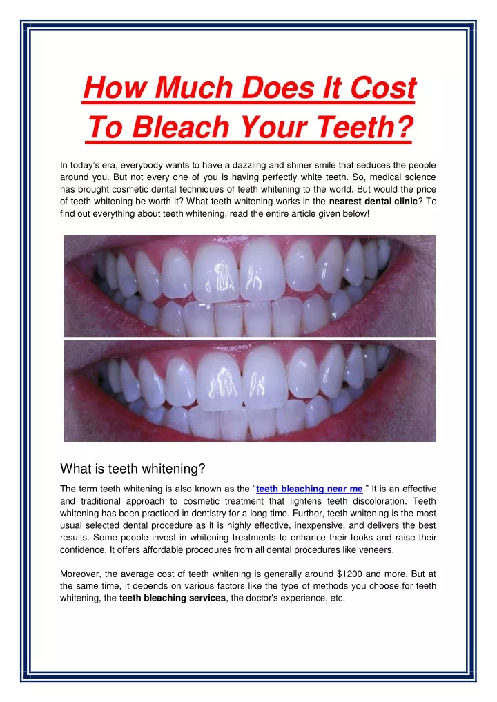 ppt-how-much-does-it-cost-to-bleach-your-teeth-1-powerpoint