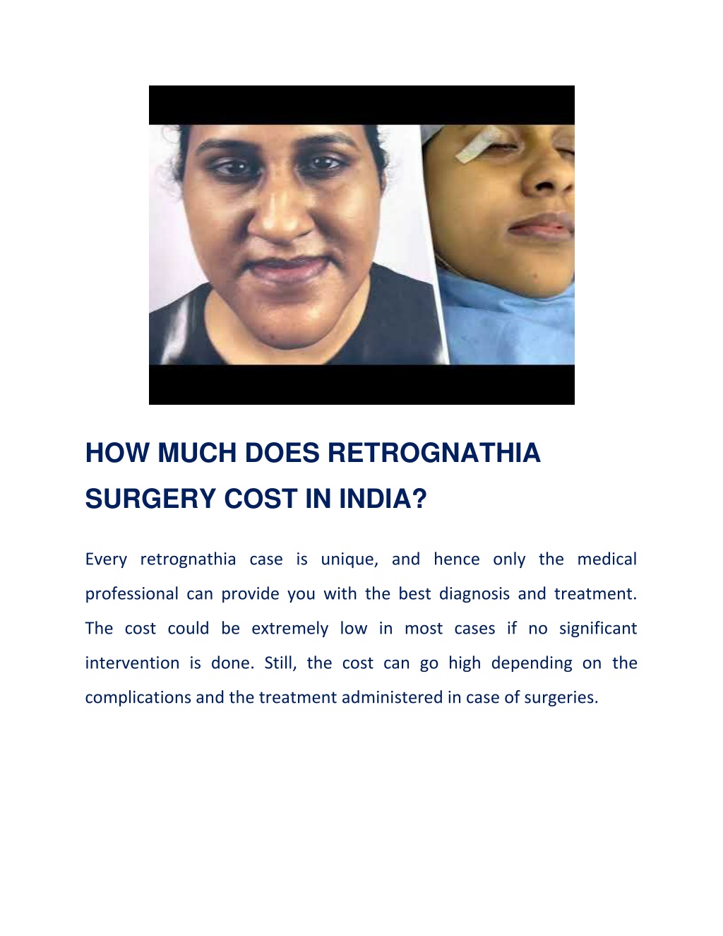 Ppt All That You Wanted To Know About Retrognathia Surgery In India Powerpoint Presentation