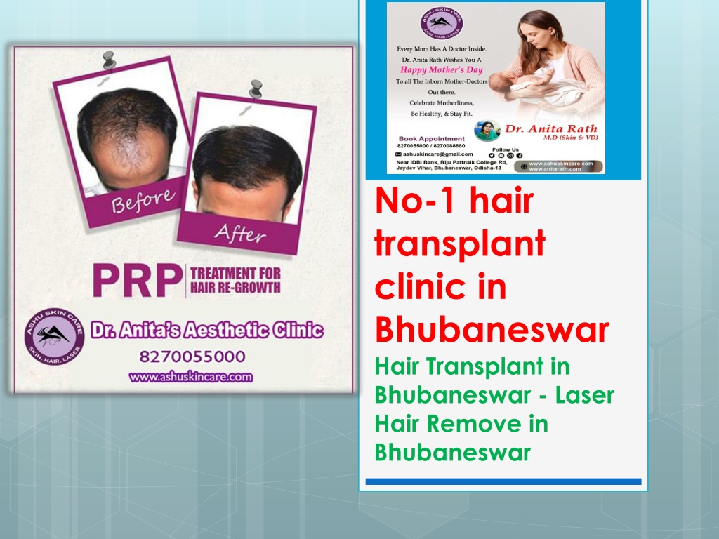 Ppt Hair Specialists In Bhubaneswar Laser Hair Removal Doctor Hair Transplant Powerpoint 5118