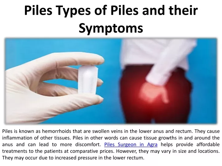 PPT - Symptoms Of Pile And Their Types PowerPoint Presentation, Free ...