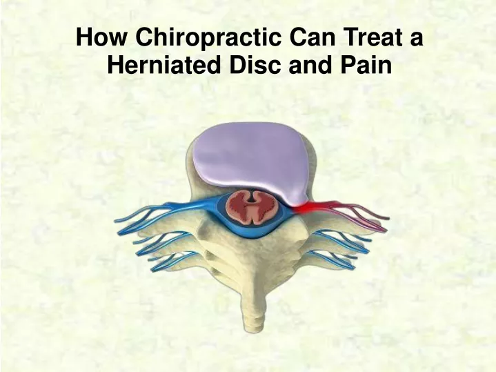 PPT How Chiropractic Can Treat a Herniated Disc and Pain PowerPoint