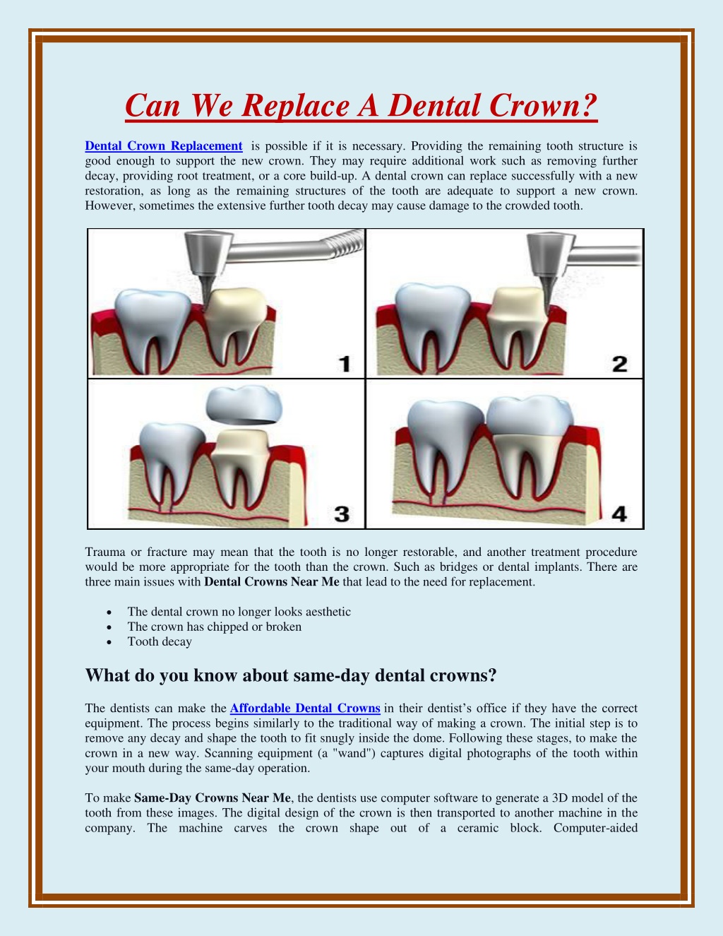 Ppt Can We Replace A Dental Crown Powerpoint Presentation Free Download Id 11356206