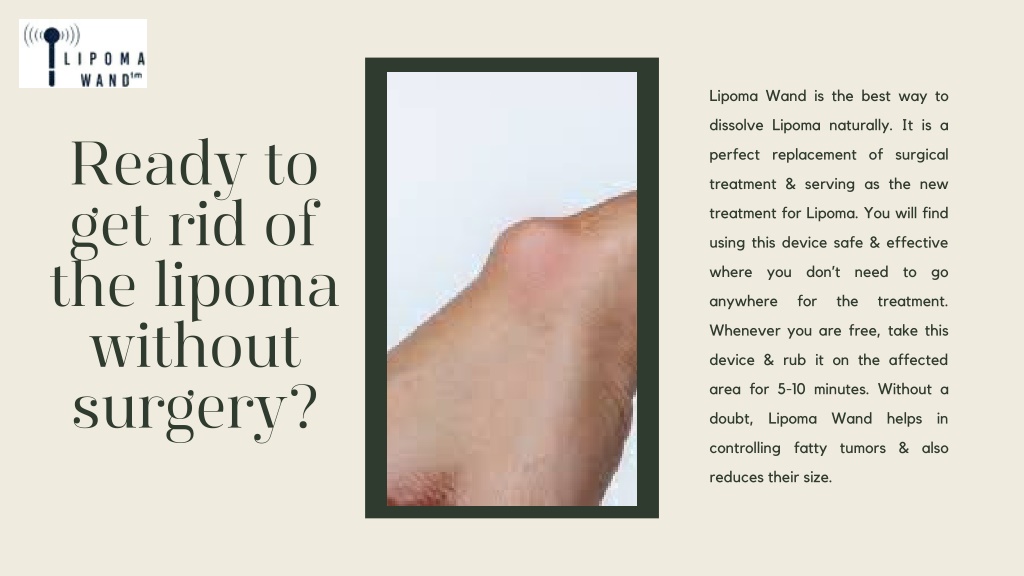 Ppt Ready To Get Rid Of The Lipoma Without Surgery Powerpoint Presentation Id11375018