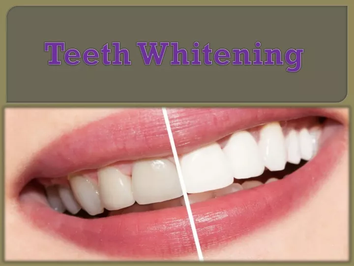 Ppt Teeth Whitening Powerpoint Presentation Free Download Id 11375772