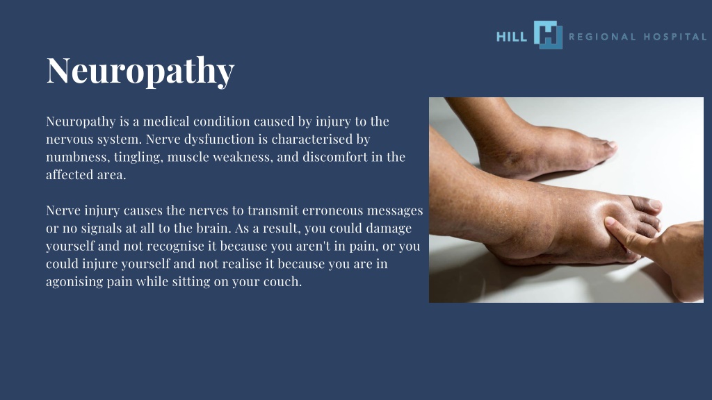 Ppt Neuropathy Causes Symptoms And Treatments Hill Regional Hospital Powerpoint Presentation 