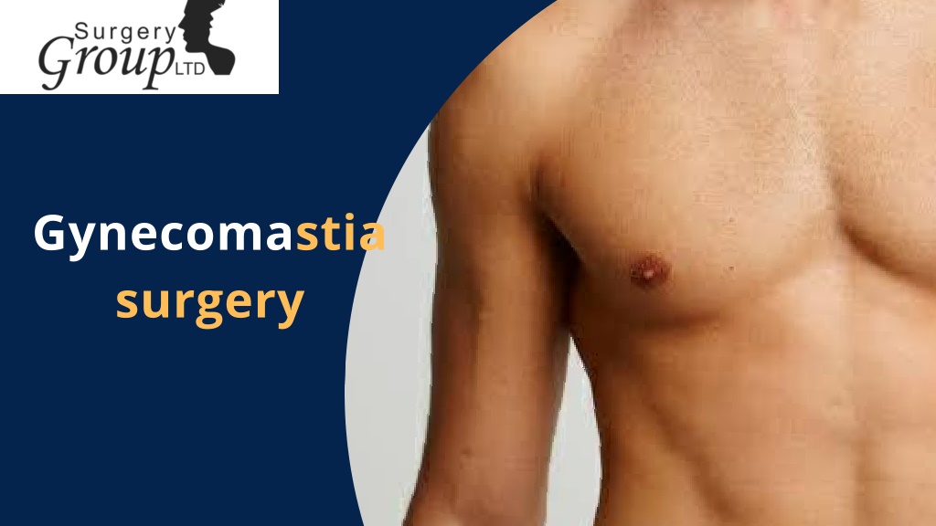 PPT - Gynecomastia | Surgery Group PowerPoint Presentation, Free ...