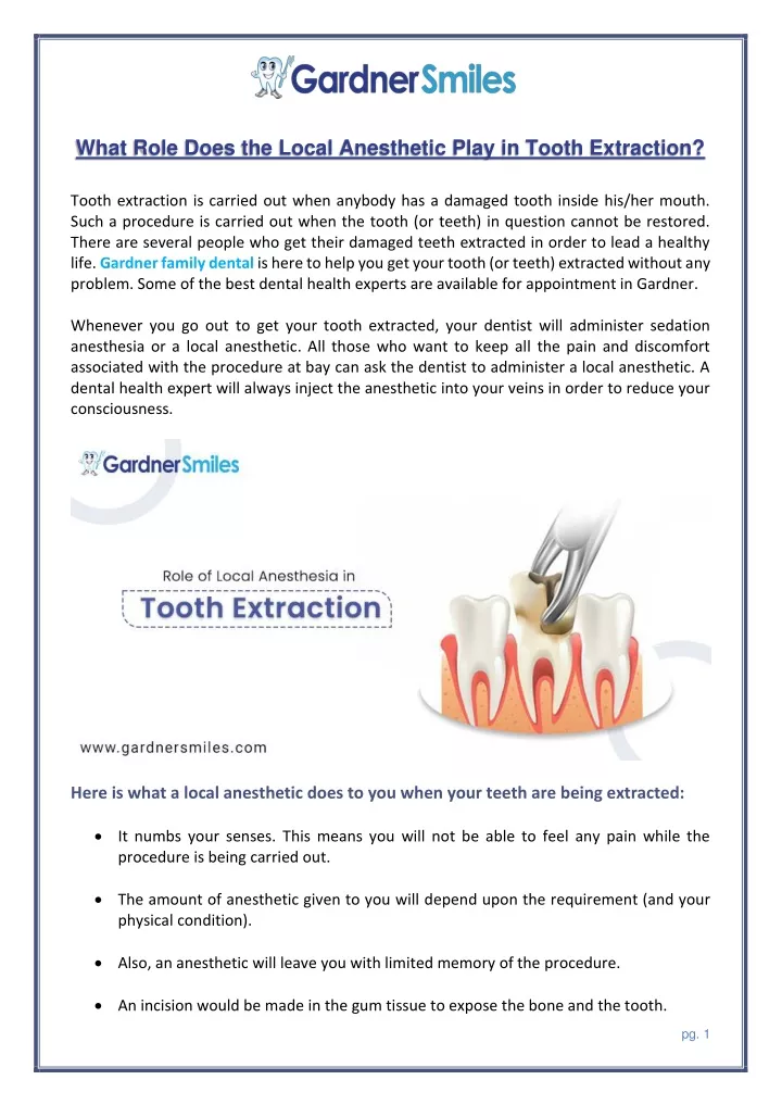 PPT Role of Local Anesthesia in Tooth Extraction PowerPoint Presentation ID11389121