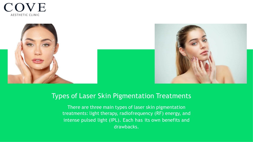 PPT Laser Skin Pigmentation Treatment in Singapore PowerPoint