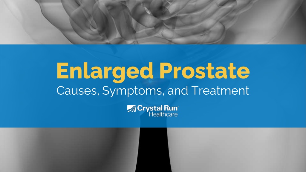 Ppt Enlarged Prostate Causes Symptoms And Treatment Powerpoint Presentation Id11408243 8711