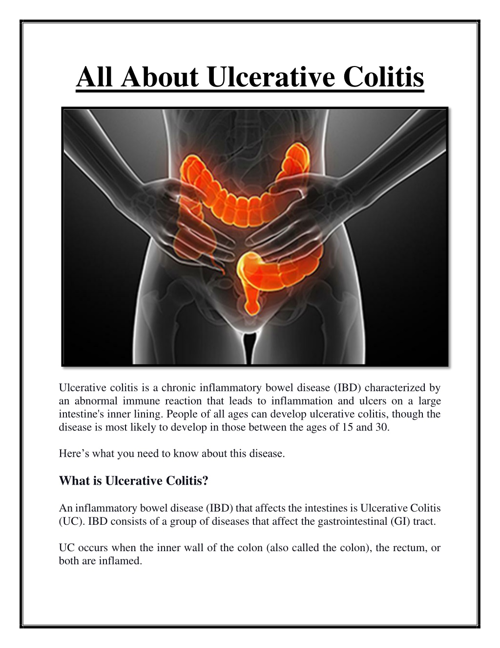Ppt All About Ulcerative Colitis Powerpoint Presentation Free Download Id11410165 9659