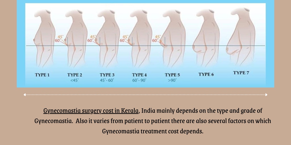 PPT - Gynecomastia surgery cost in Kerala PowerPoint Presentation, free ...