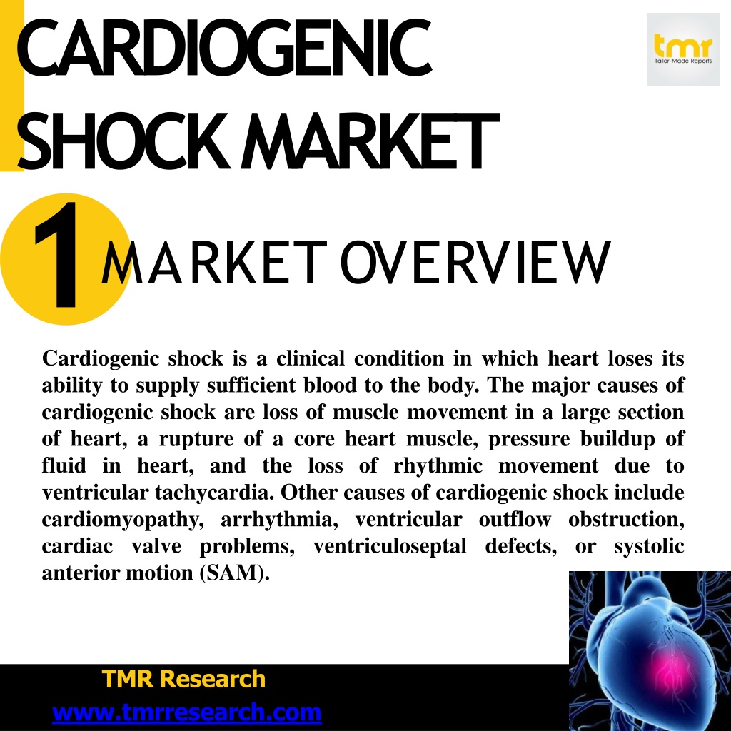 PPT - What Is Cardiogenic Shock? PowerPoint Presentation, Free Download ...