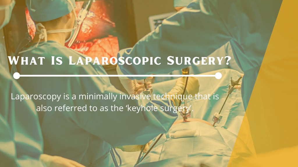 PPT - Benefits Offered By Laparoscopic Uro Surgery PowerPoint ...