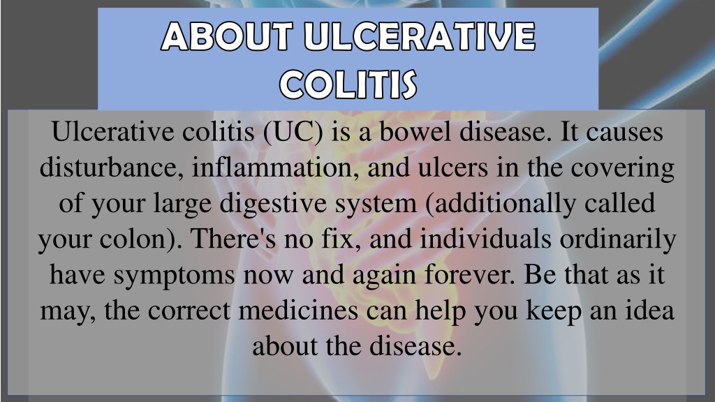 PPT - Ulcerative Colitis Causes And Risk Factors & VA Disability Rating ...