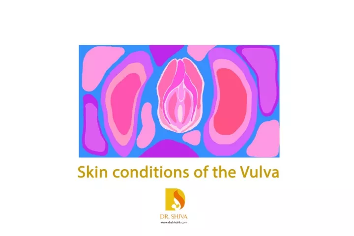 Black Spot On Vulva During Pregnancy