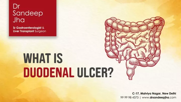 ppt-duodenal-ulcer-cause-symptoms-and-treatment-by-dr-sandeep-jha