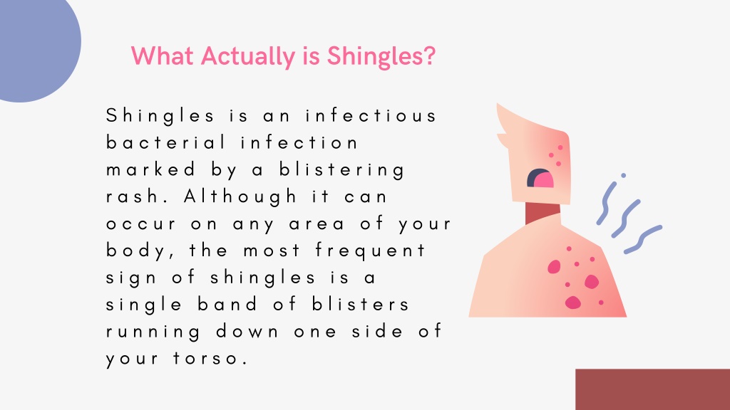 PPT - Disease of Shingles: 10 Tips to prevent | Healthlifenews ...