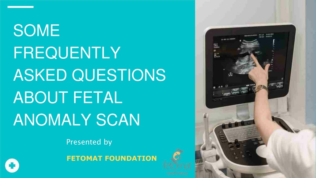 PPT - Check Out Some Commonly Asked Questions About Fetal Anomaly Scan ...