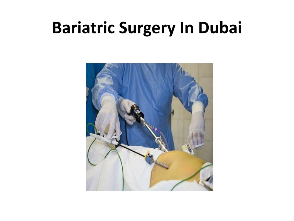 PPT - Bariatric Surgery In Dubai PowerPoint Presentation, Free Download ...