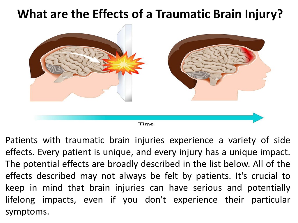 PPT - Boorgula Meher Thej - What Are The Effects Of A Traumatic Brain ...