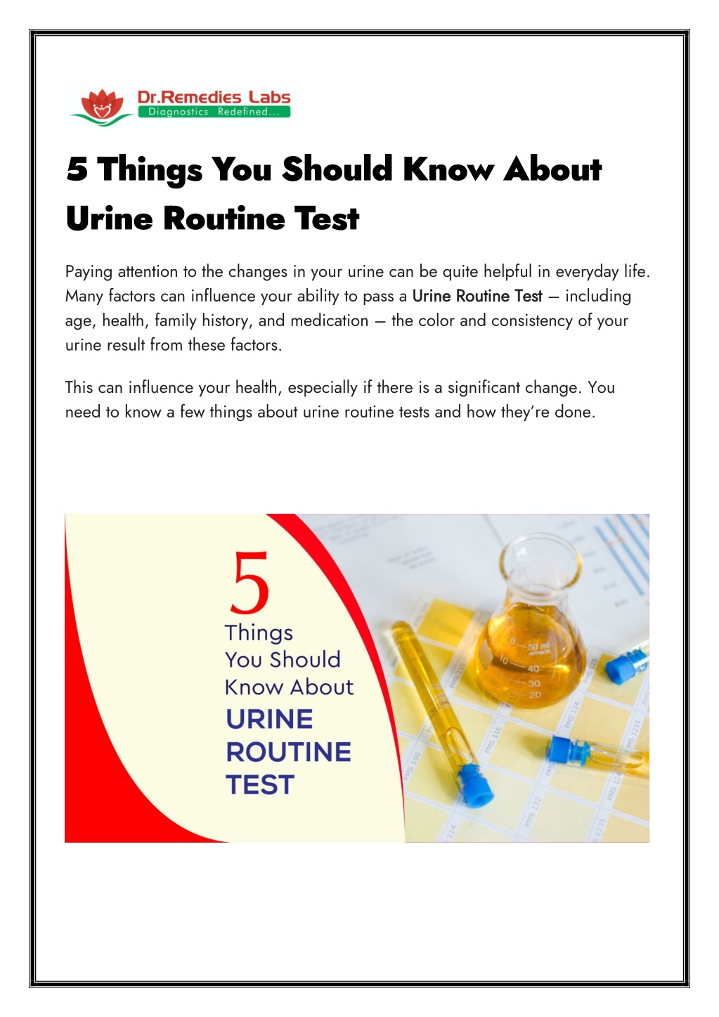 ppt-5-things-you-should-know-about-urine-routine-test-powerpoint