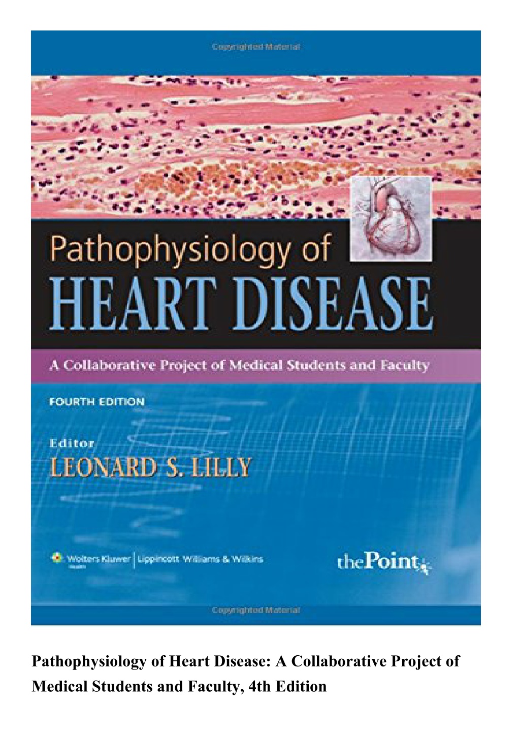 PPT - EBOOK Pathophysiology of Heart Disease A Collaborative Project of ...