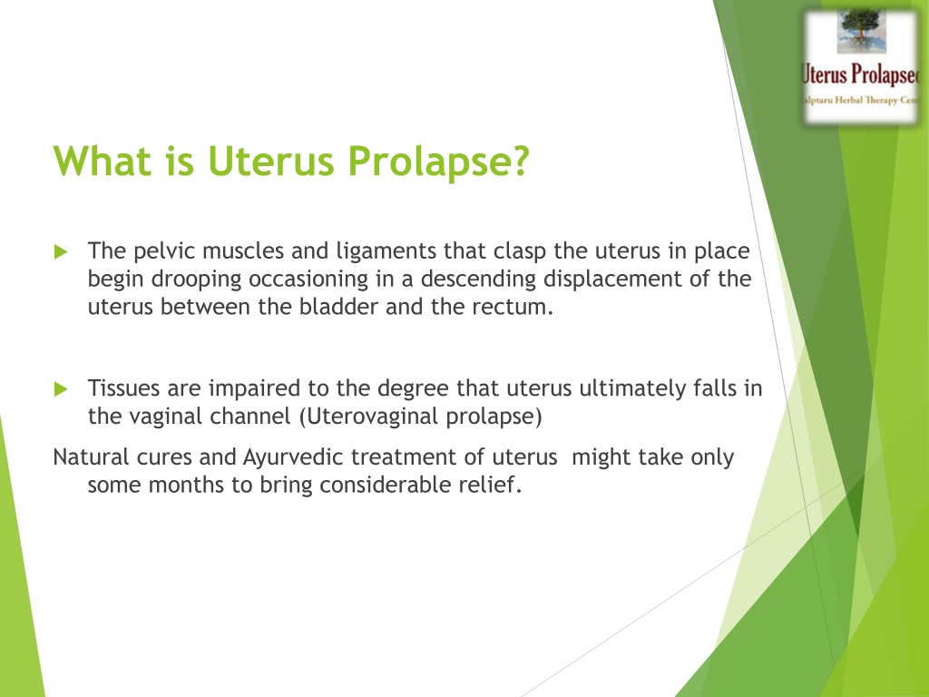 Ppt Best Non Surgical Treatment Of Uterus Prolapse Powerpoint Presentation Id11472786 