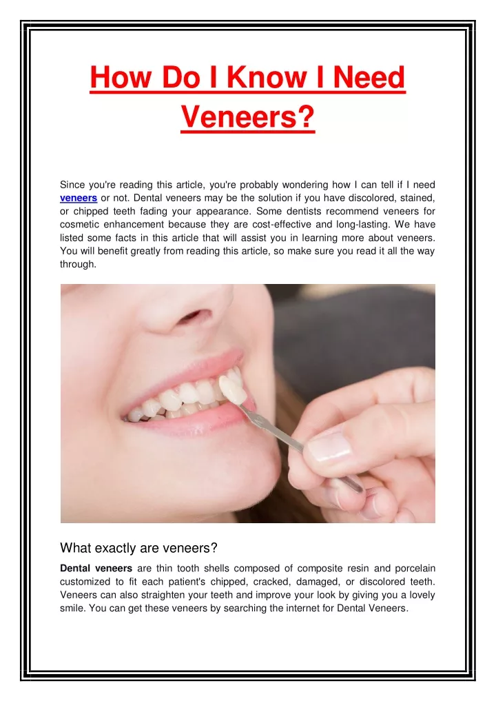 ppt-how-do-i-know-i-need-veneers-powerpoint-presentation-free