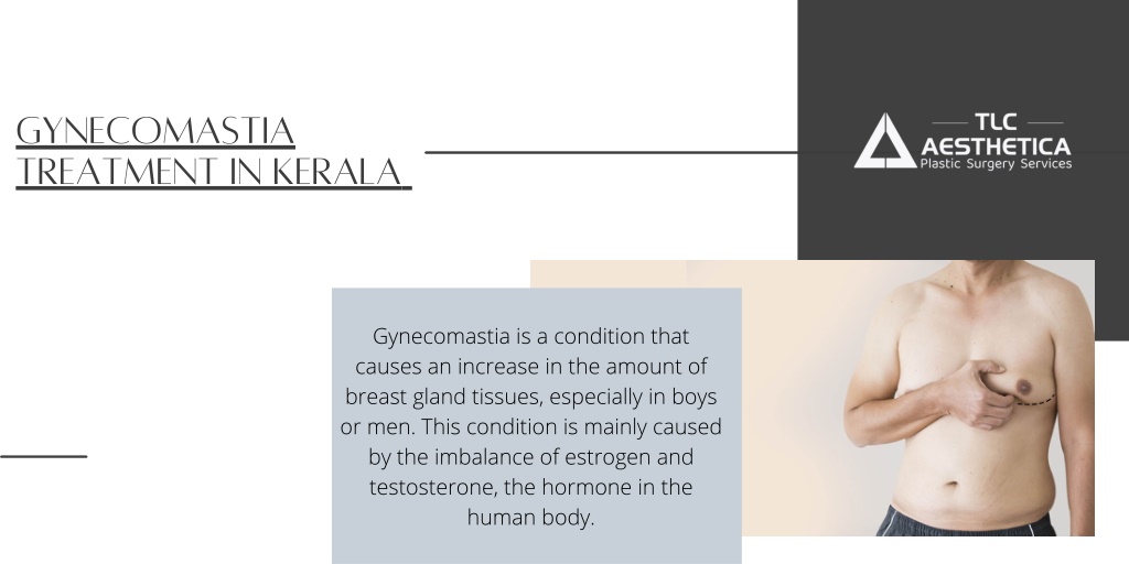 Ppt Gynecomastia Treatment Cost In Kerala Powerpoint Presentation Free Download Id11497767 3630