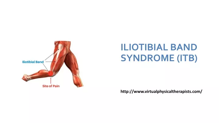 PPT - ILIOTIBIAL BAND SYNDROME (ITB) PowerPoint Presentation, free ...