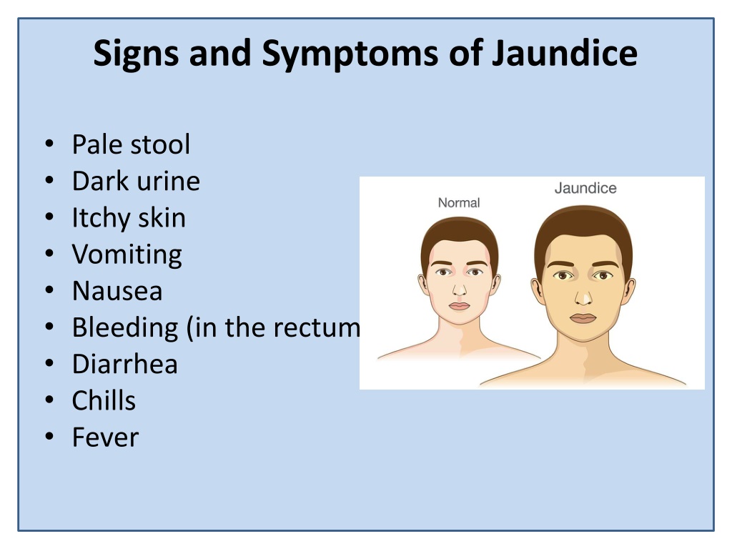 Ppt Jaundice14 Powerpoint Presentation Free Download Id11499749 9561