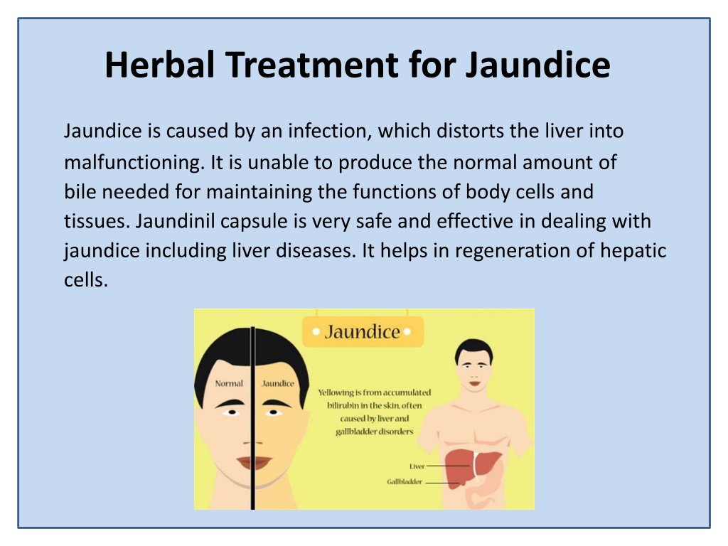 Ppt Jaundinil Capsule To Get Rid Of Jaundice Powerpoint Presentation