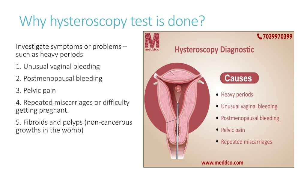 Ppt Hysteroscopy Diagnostic Ppt Powerpoint Presentation Free