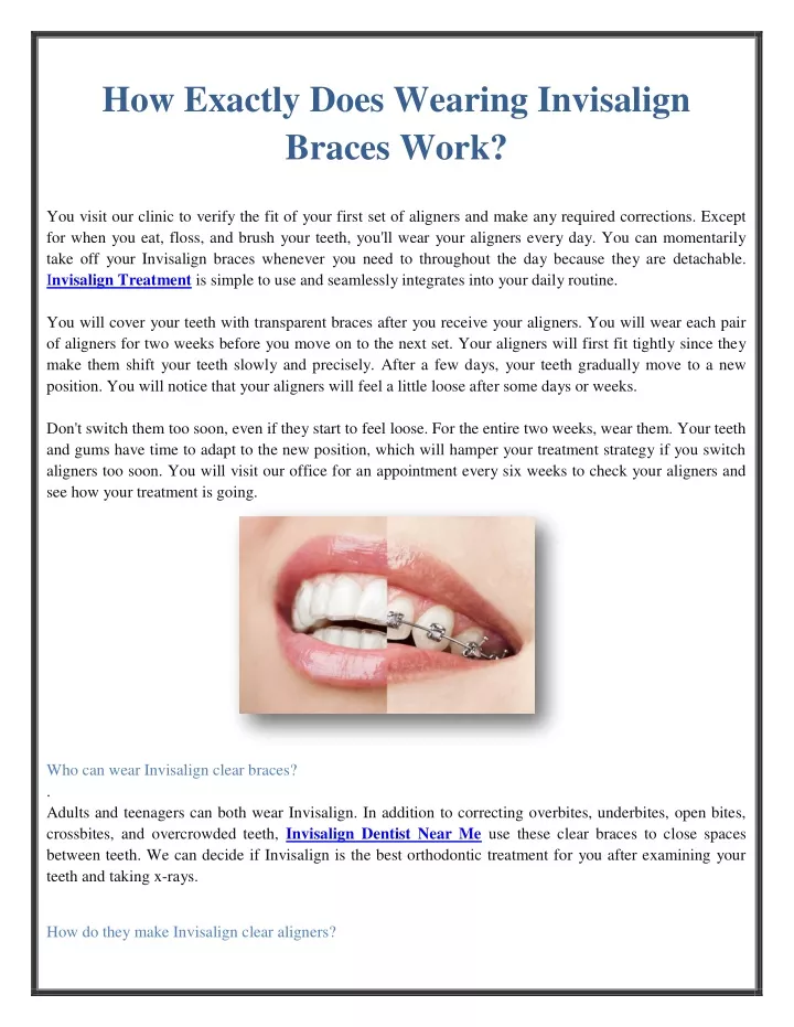 PPT How Exactly Does Wearing Invisalign Braces Work? PowerPoint