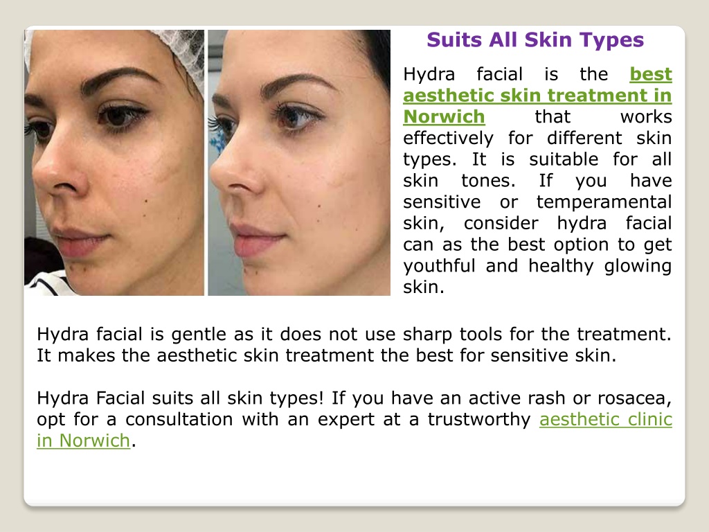 PPT Hydra Facial Skin Treatments in Norwich PowerPoint Presentation