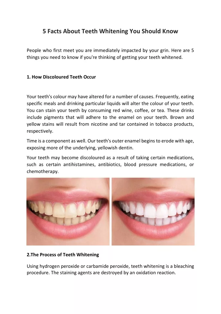 PPT - 5 Facts About Teeth Whitening You Should Know PowerPoint ...