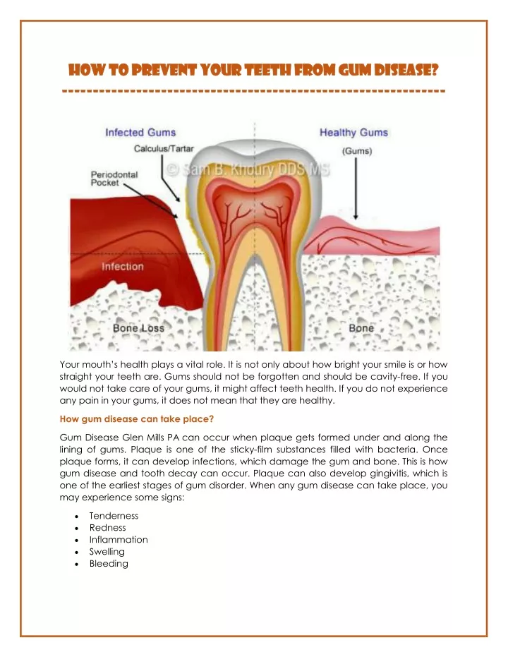 ppt-how-to-prevent-your-teeth-from-gum-disease-powerpoint