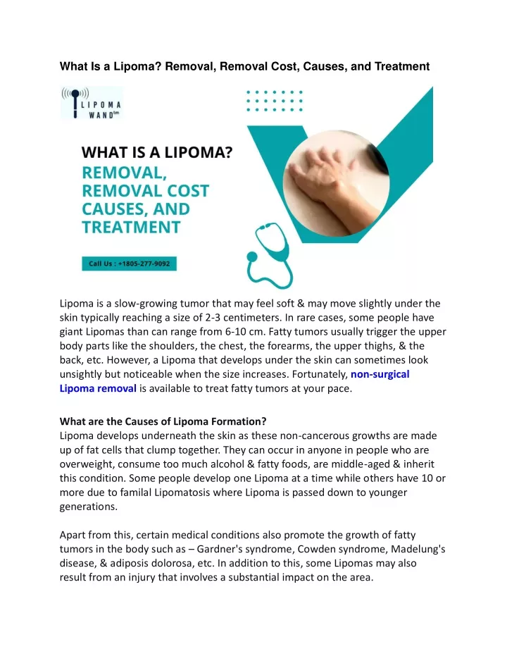 PPT What Is a Lipoma, Removal, Removal Cost, Causes, and Treatment